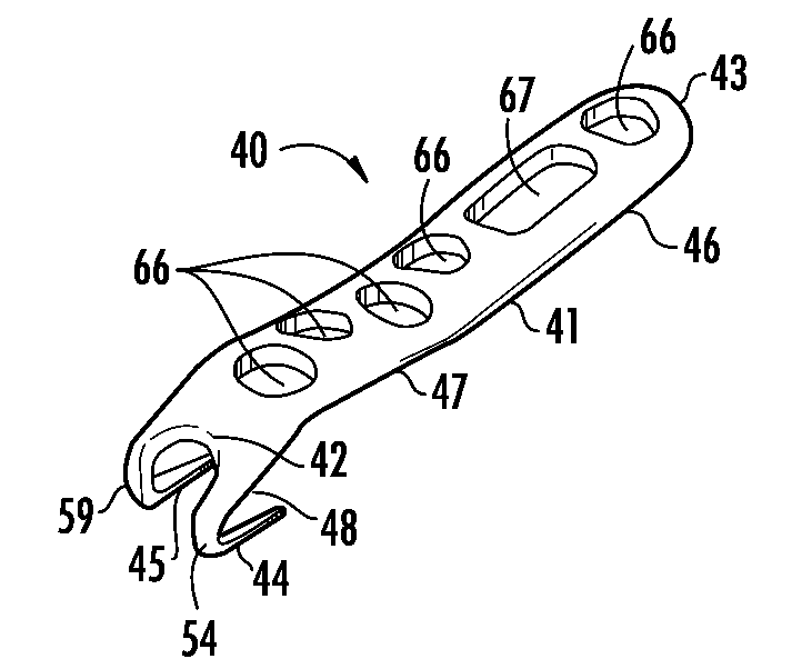 Contoured bone plate for fracture fixation having hook members and drill guide for same