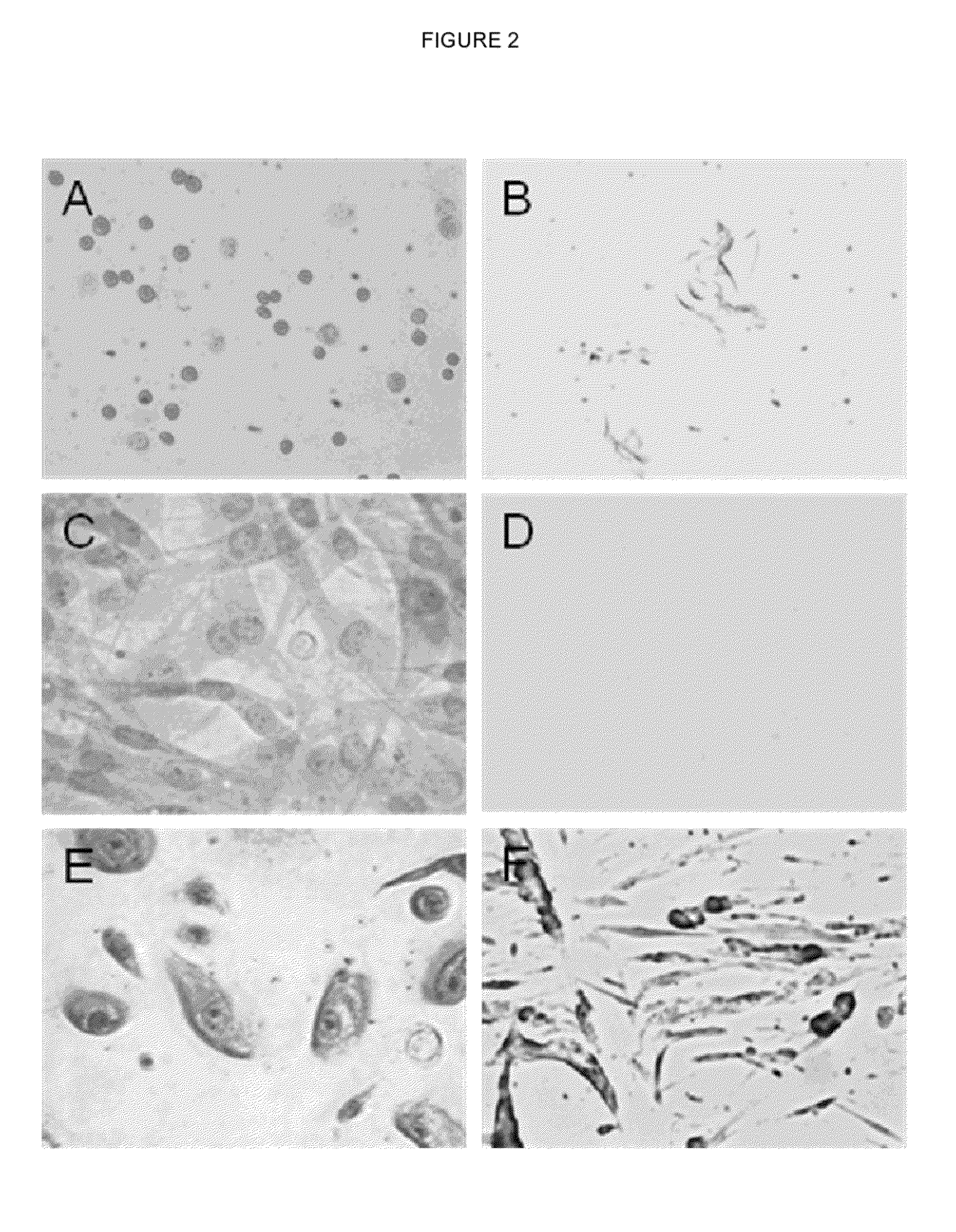 Biomaterial based on Wharton's jelly from the human umbilical cord