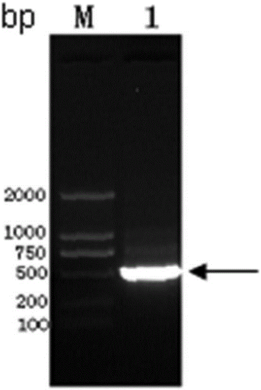 Truncated recombinant protein of Riemerella anatipestifer (RA) serum type 1 siderophore receptor protein (SRP) and application of truncated recombinant protein