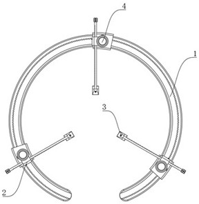 Incision opening device for minimally invasive surgery