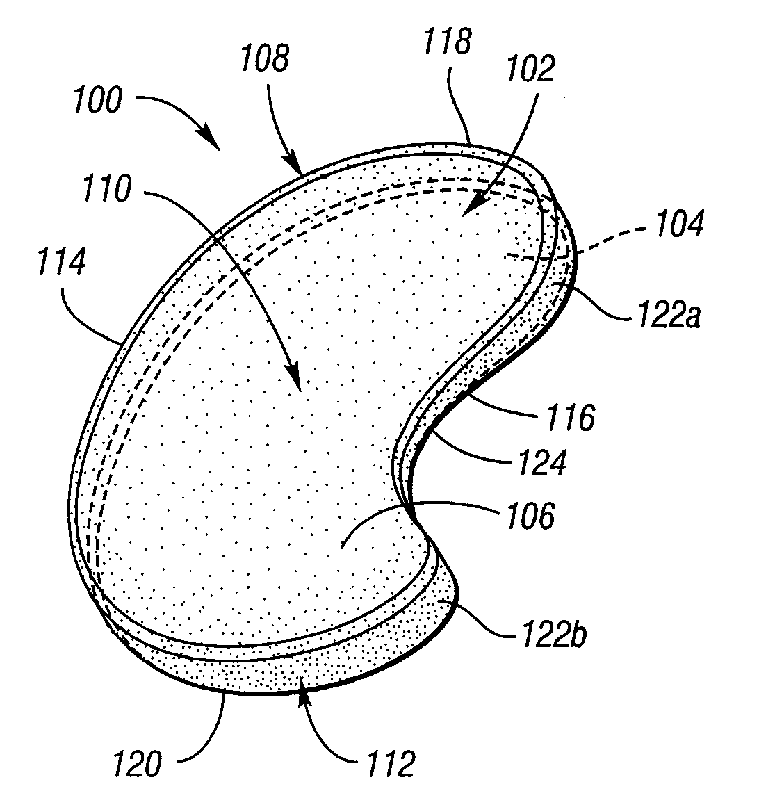 Surgically Implantable Knee Prosthesis