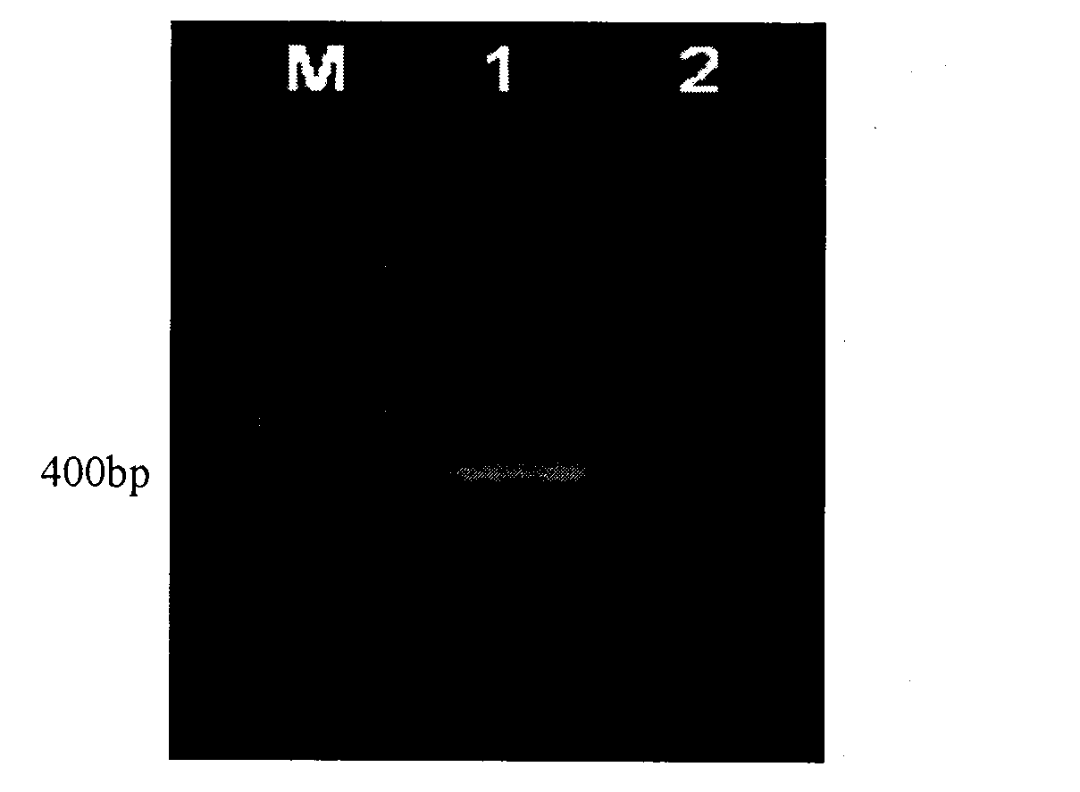 Construction method of recombinant adeno-associated virus vector of targeting interference SOCS1 gene and application of construction method