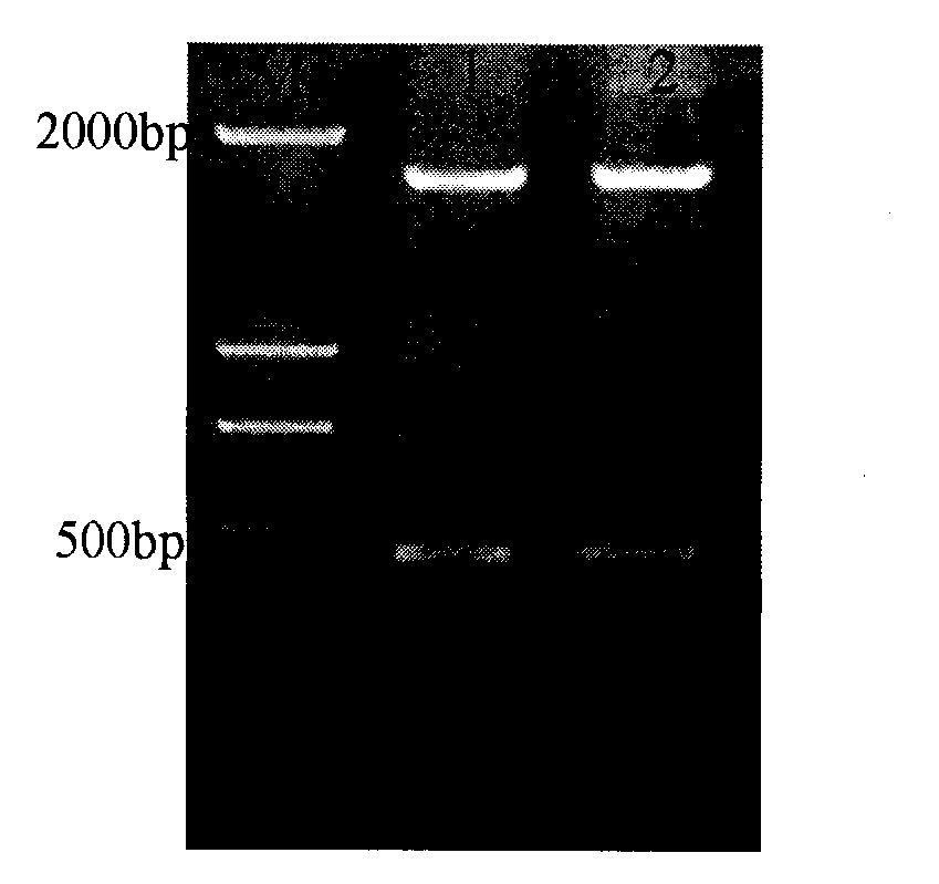 Construction method of recombinant adeno-associated virus vector of targeting interference SOCS1 gene and application of construction method