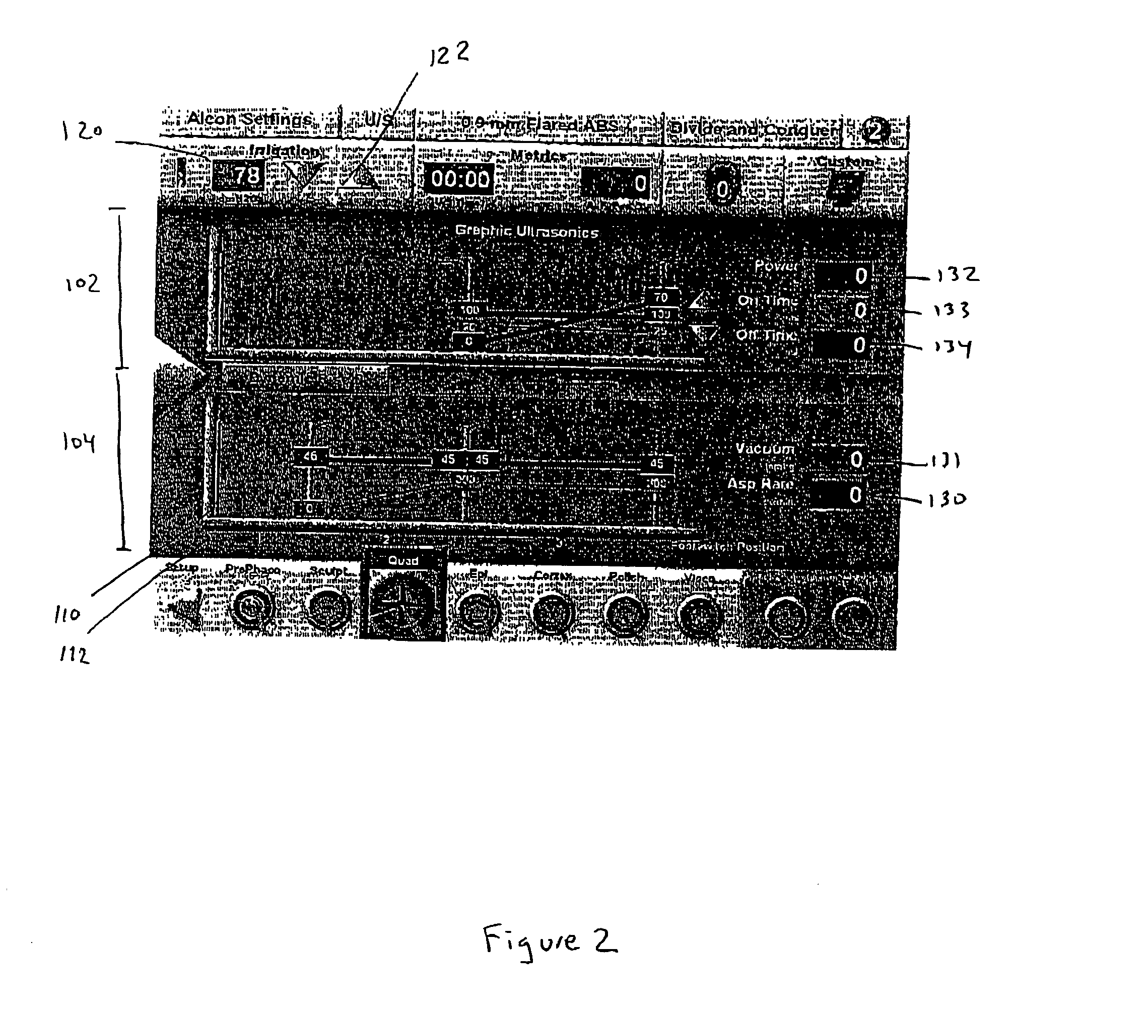 Graphical user interface system and method for representing and controlling surgical parameters