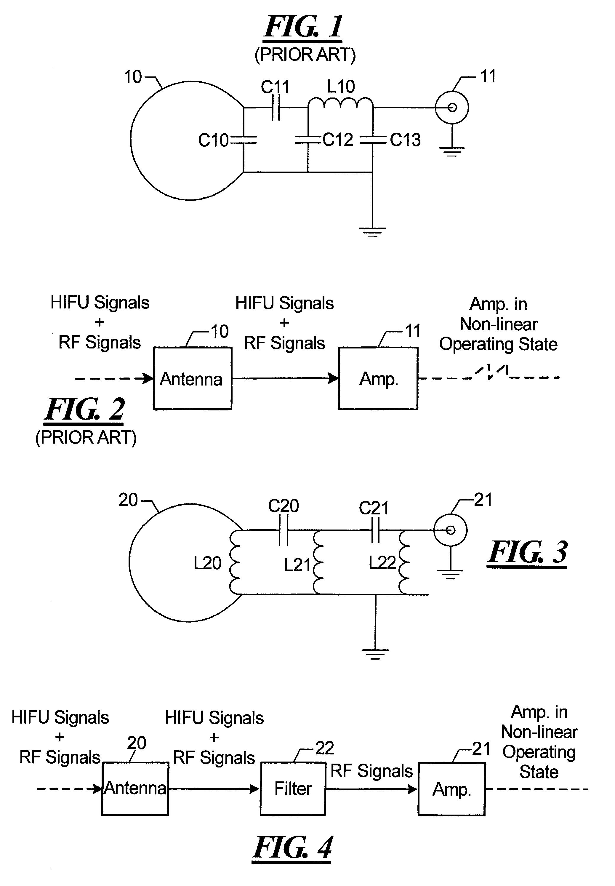 Hifu-compatible reception coil for MRI RF signals and signal receiving method