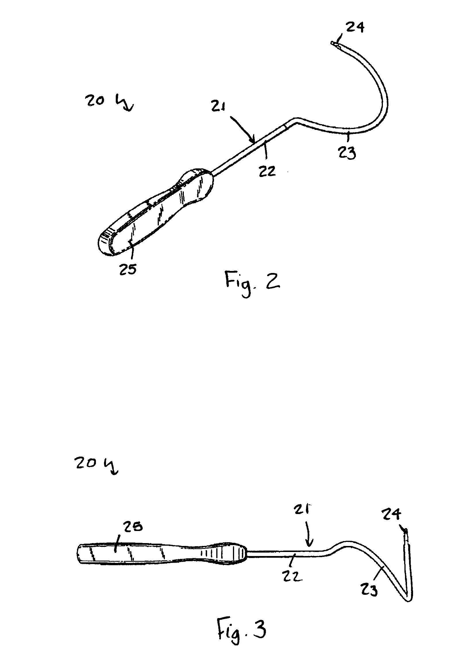 Method of treating anal incontinence