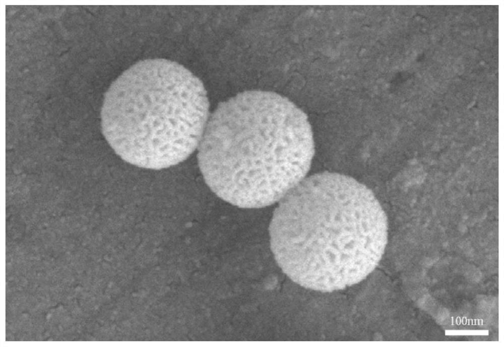 Mesoporous bioactive glass/chitosan composite hemostatic sponge and preparation method thereof