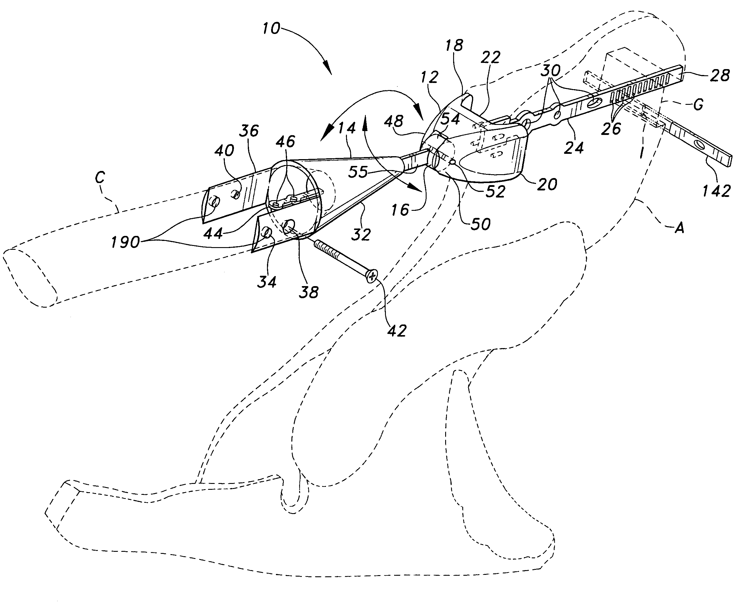 Acromioclavicular joint prosthesis