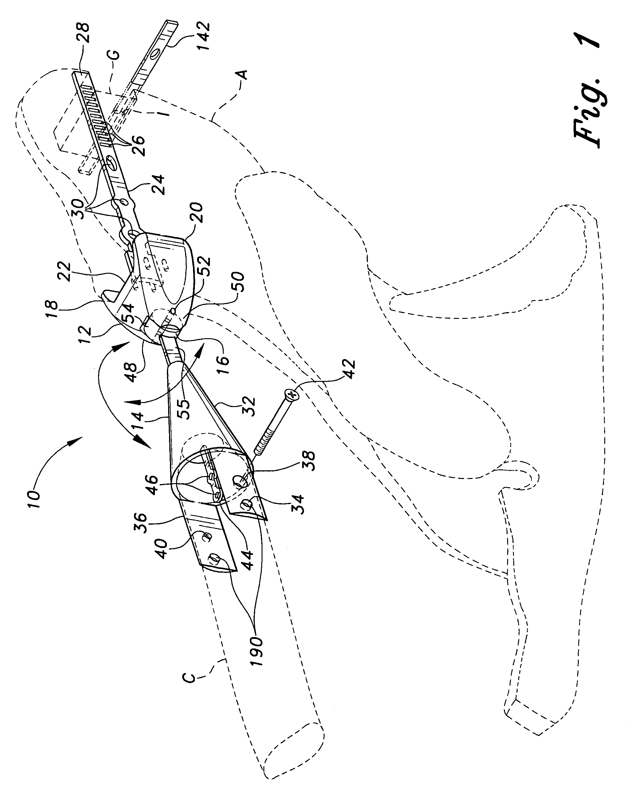 Acromioclavicular joint prosthesis