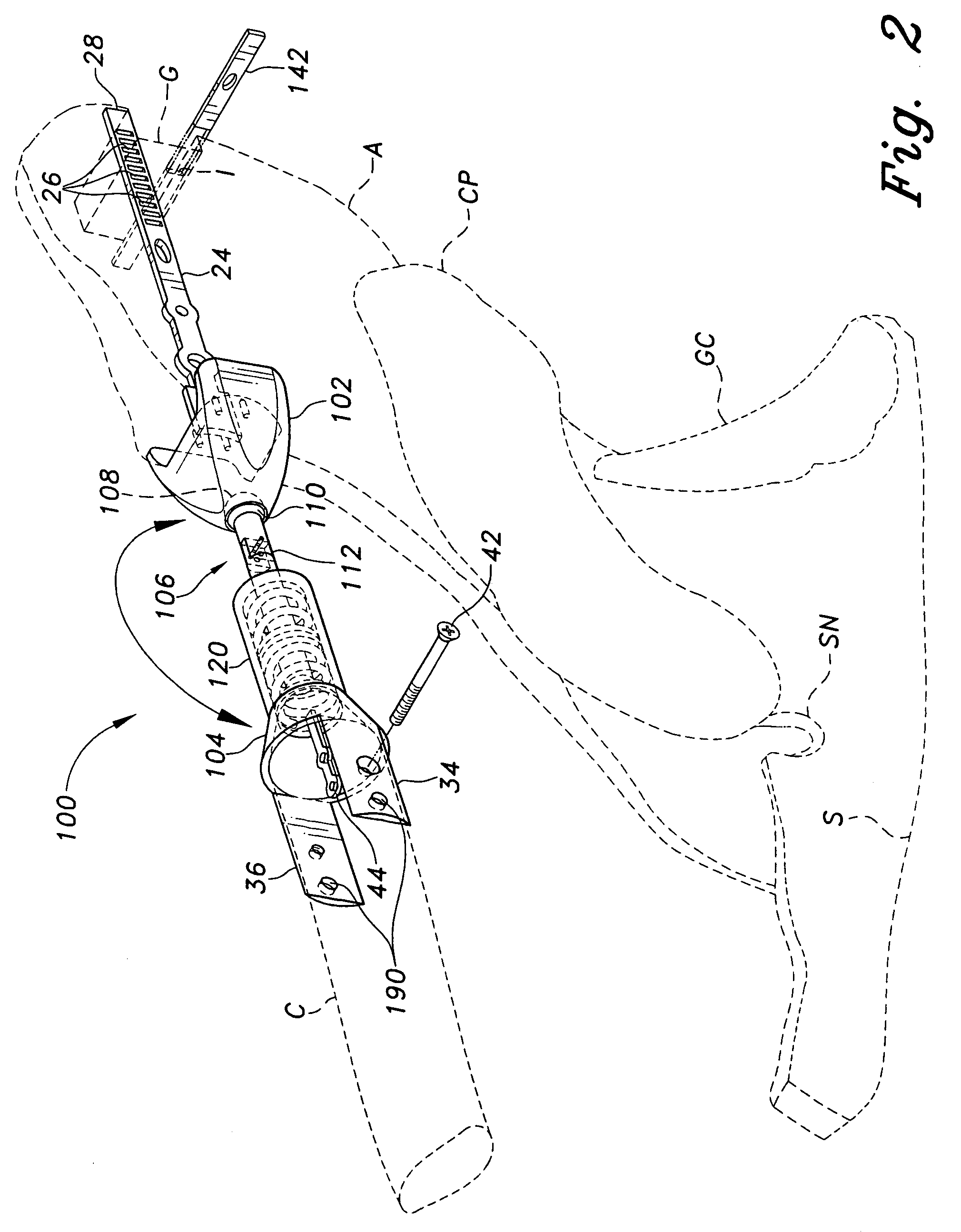 Acromioclavicular joint prosthesis