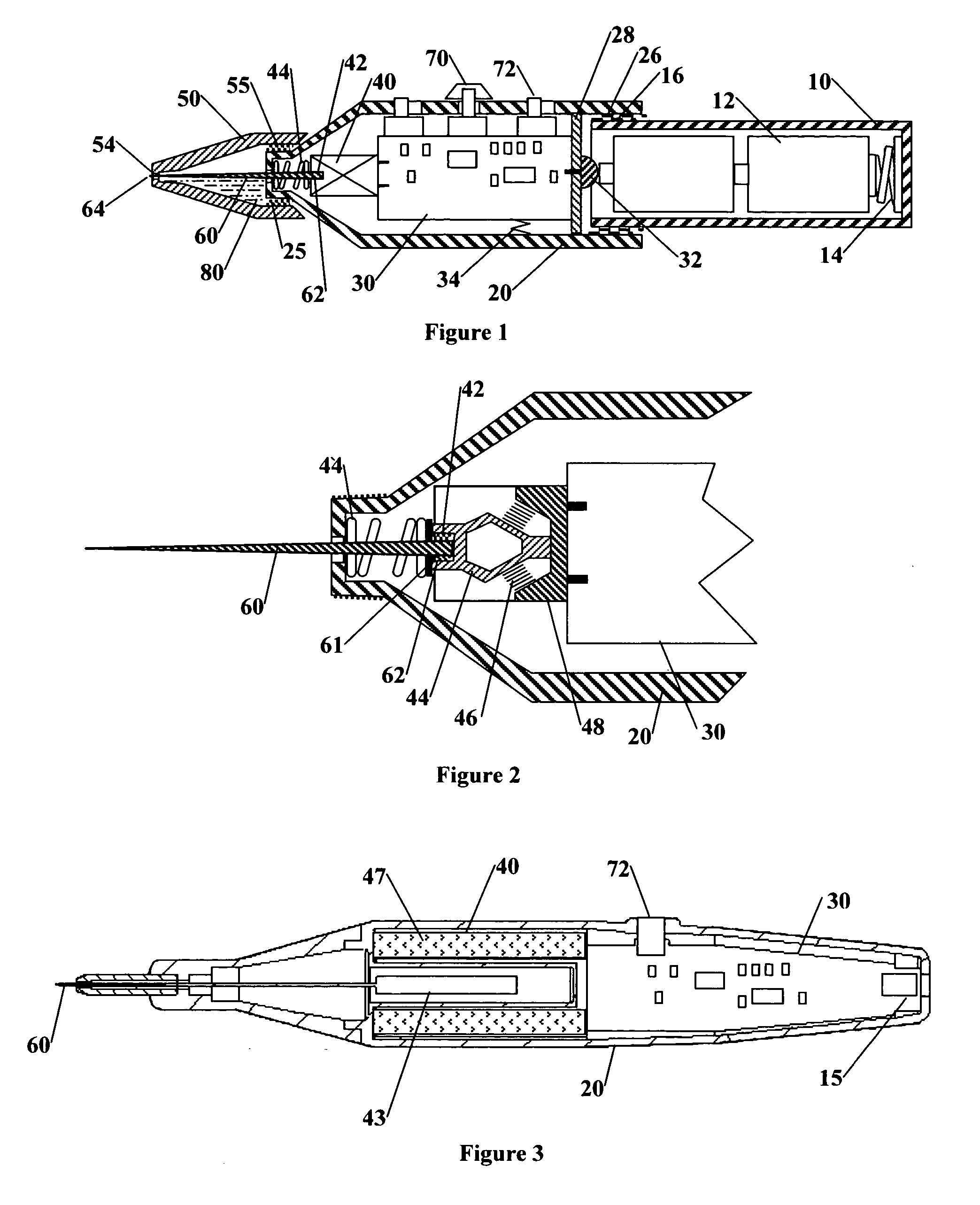 Ultrasonic pigment application device