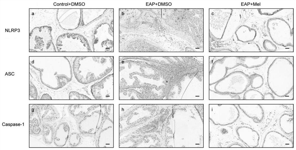 Application of melatonin to preparation of medicine for treating autoimmune prostatitis and medicine for treating autoimmune prostatitis