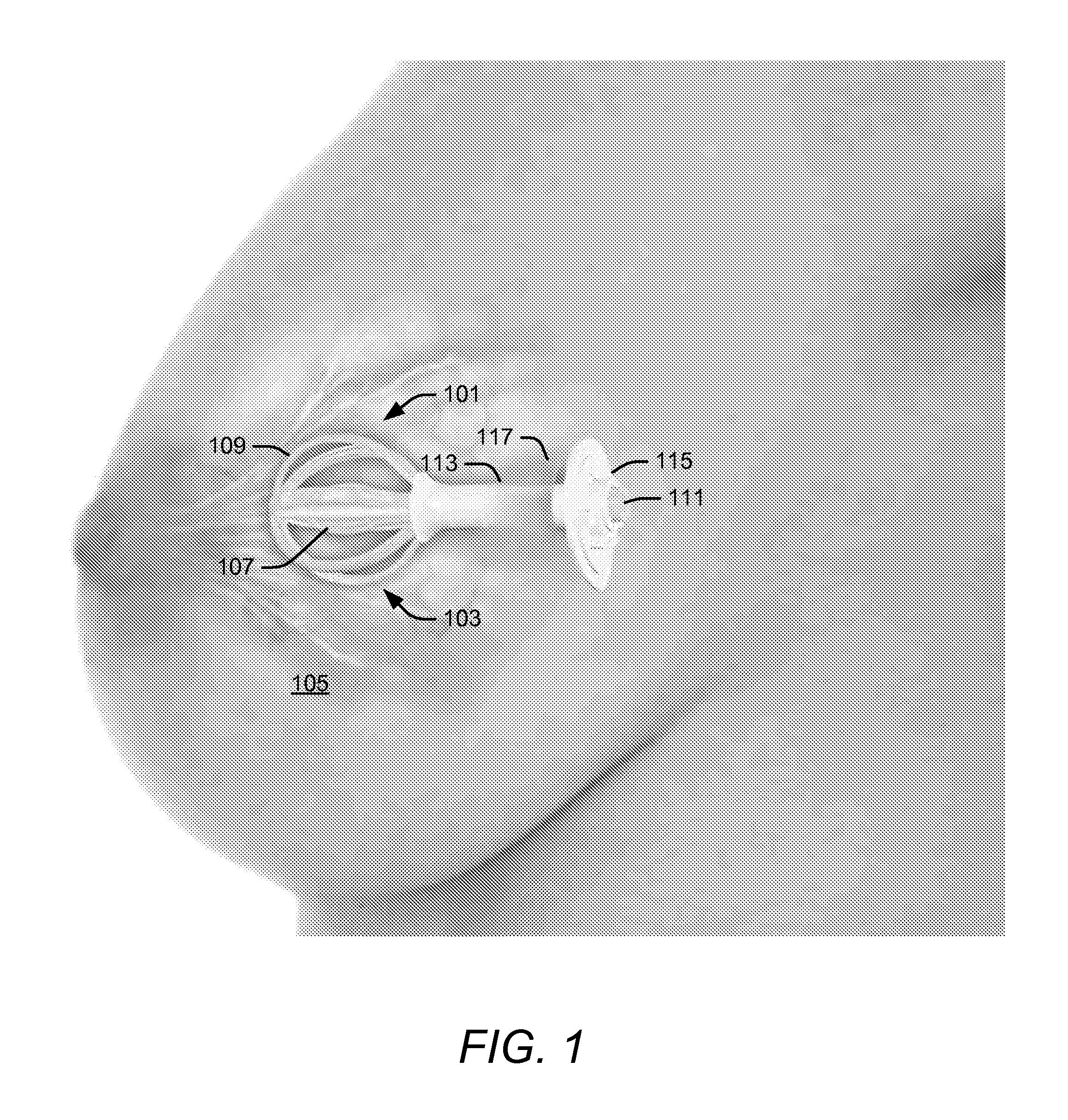 Brachytherapy Device Having an Alignment and Seal Adaptor