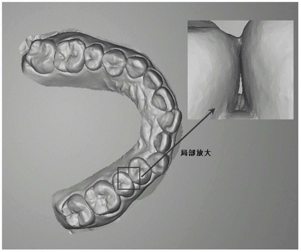 Automatic detection and repairing method of dentulous jaw black triangle