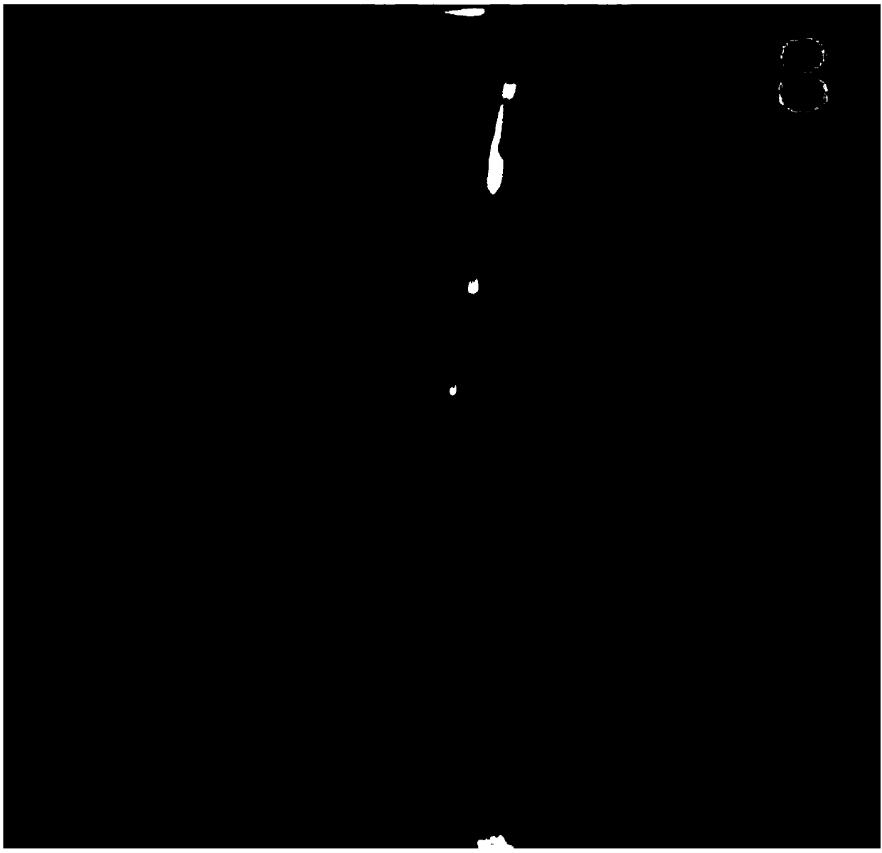 Artificial intelligence diagnosis and classification system for lumbar disc herniation