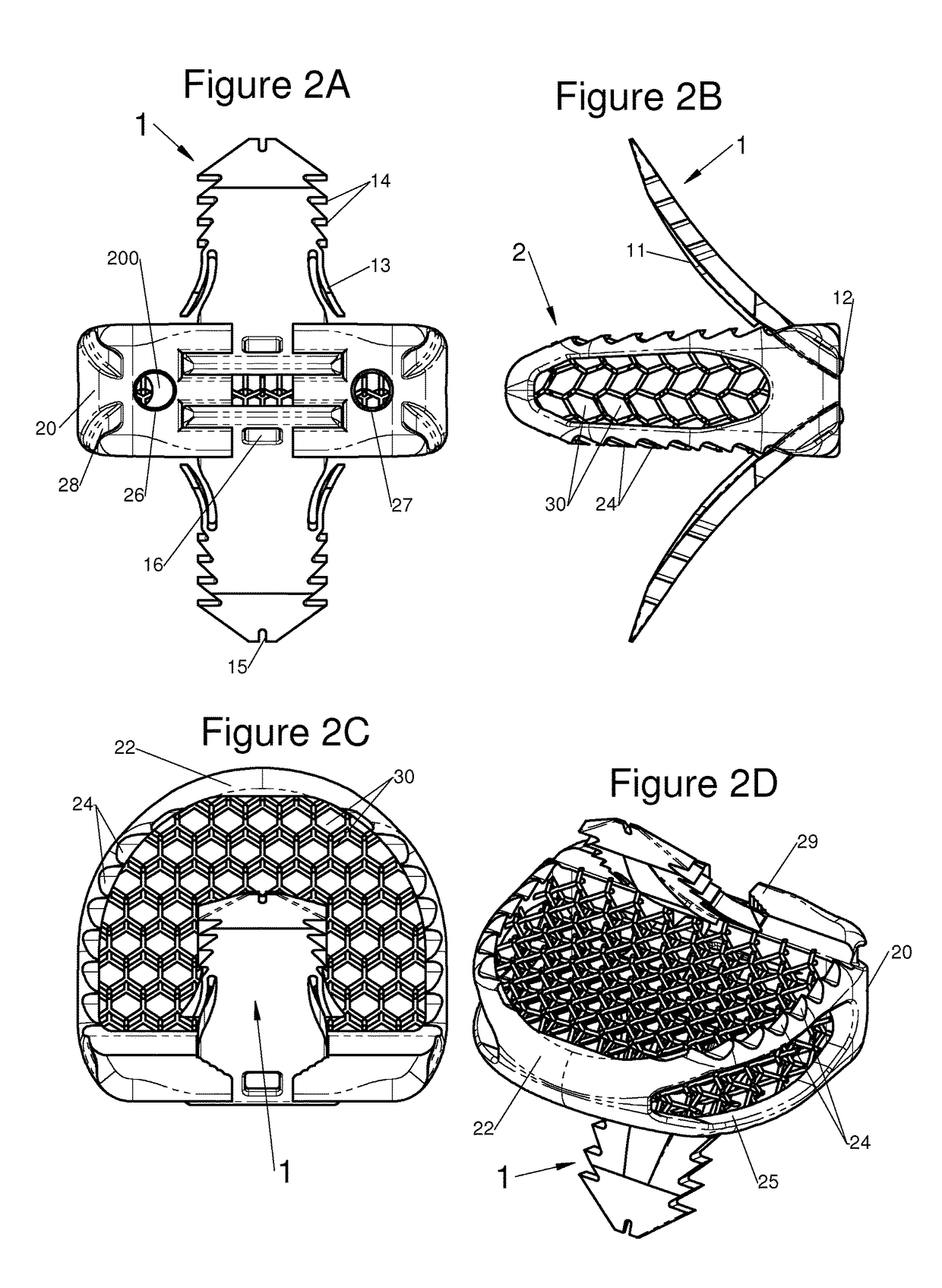 Vertebral System, Implant and Inserts for Vertebral System