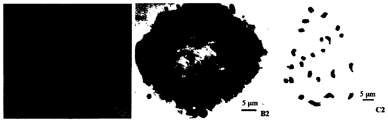 Analysis method of sharp leaf CinnamomumKanehirae Hay karyotype based on root tips