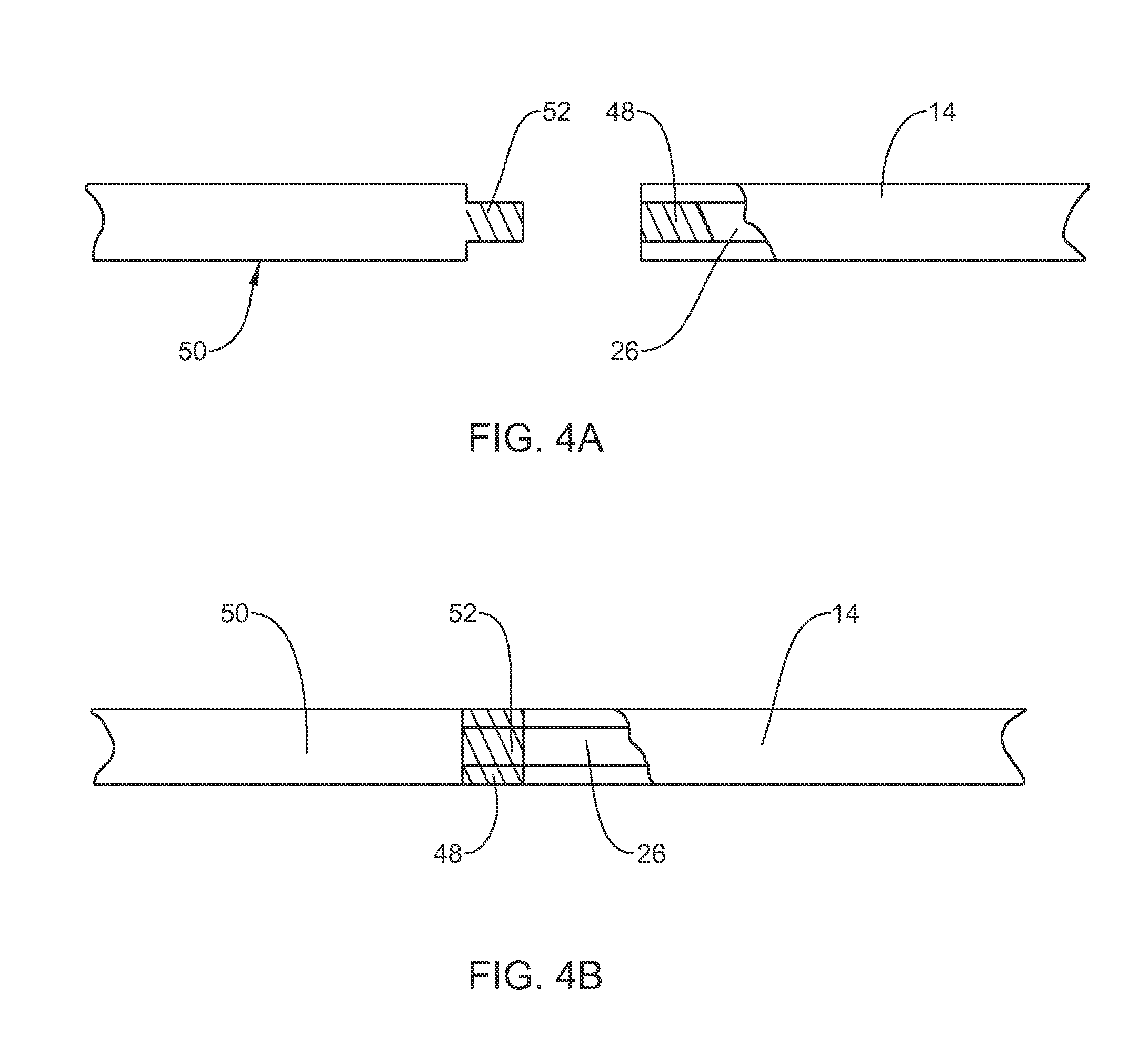 Microcatheter system