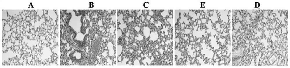 A kind of probiotic composition and its preparation and application