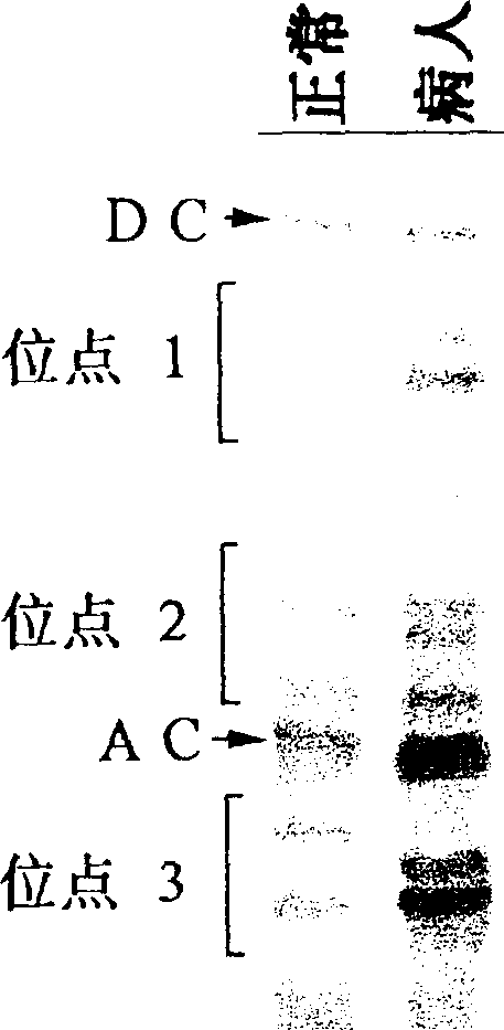 Method for detecting human No.21 triple-chromosome and reagent box