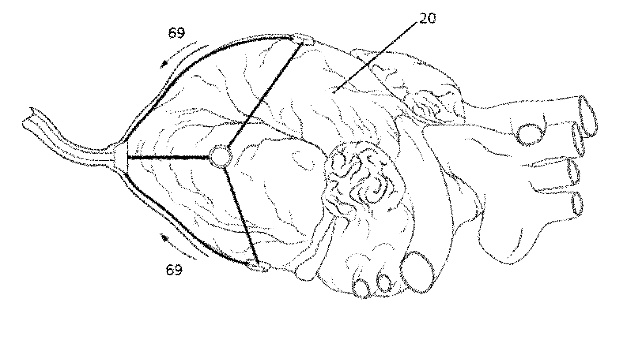 Deployable Polygonal Manipulator for Minimally Invasive Surgical Interventions