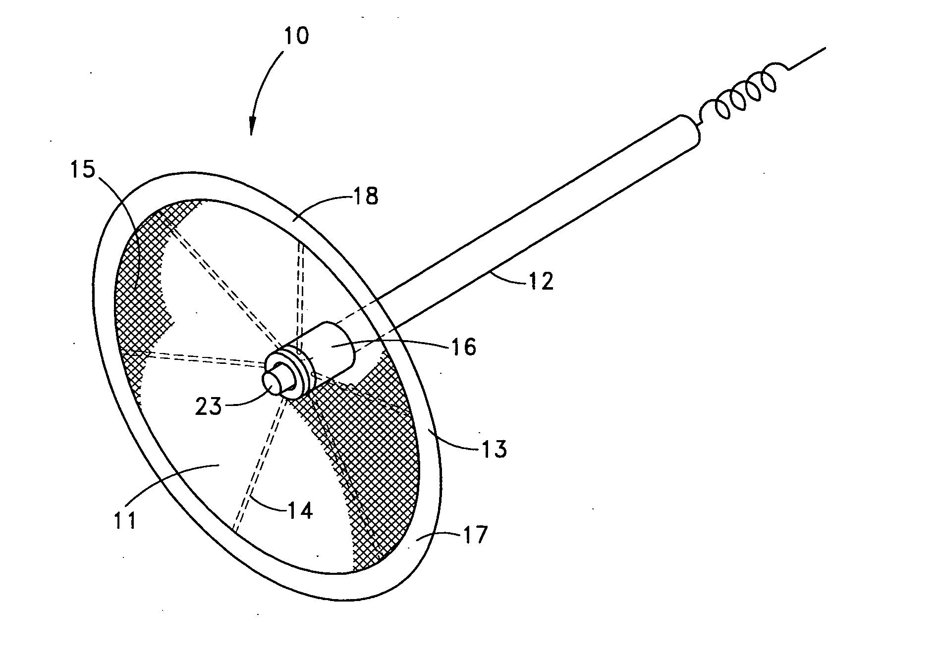 Method for left atrial appendage occlusion