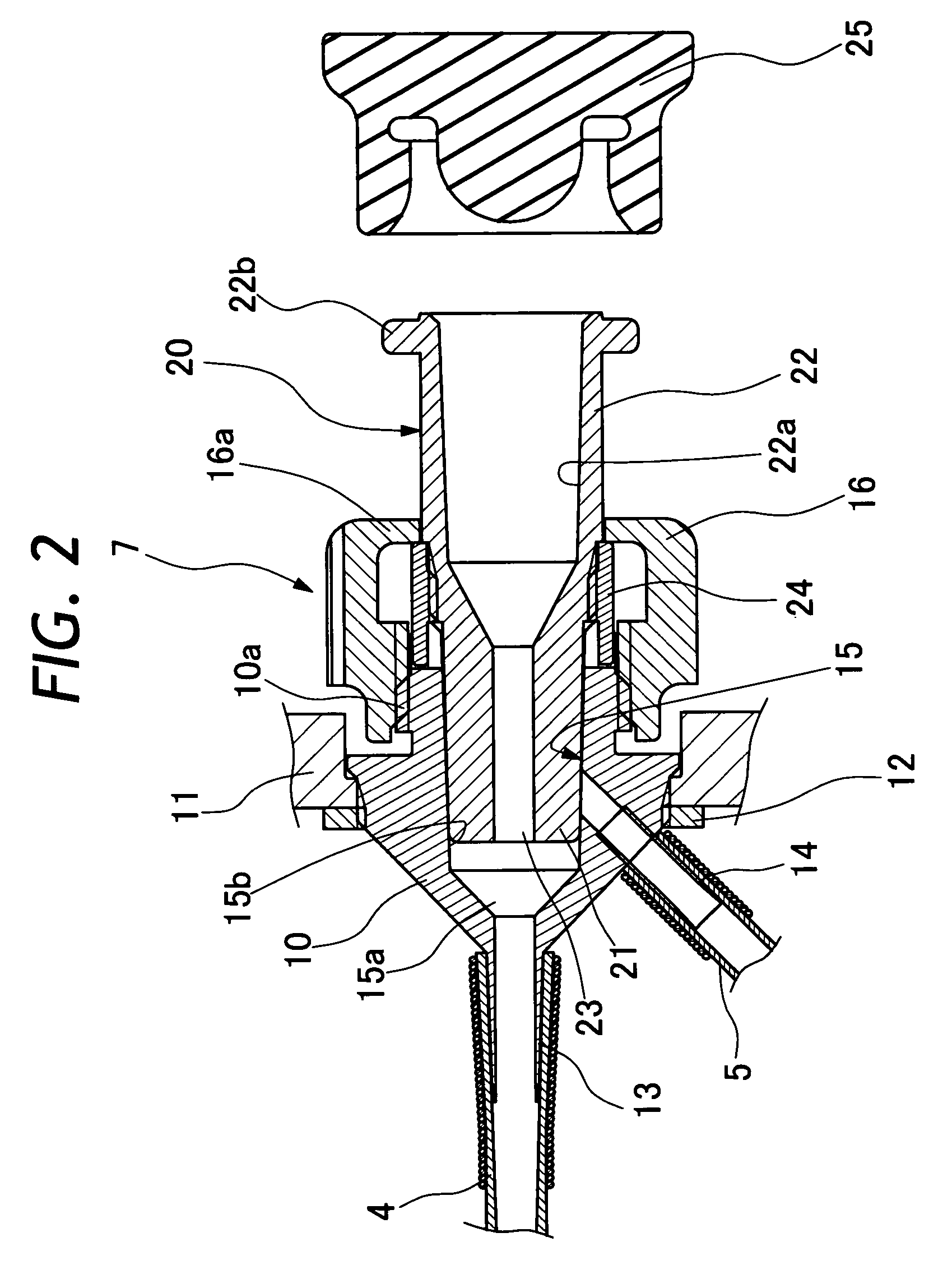 Endoscopic fluid supply conduit system