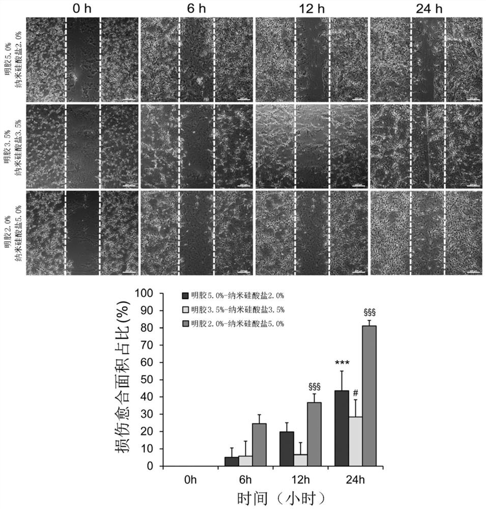 Tissue engineering nerve complex as well as preparation method and application thereof