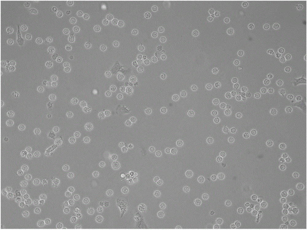 Improved method for cultivating NK (natural killer) cells