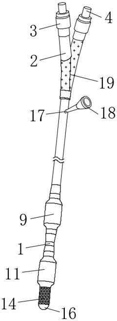 Cervical dilatation balloon catheter