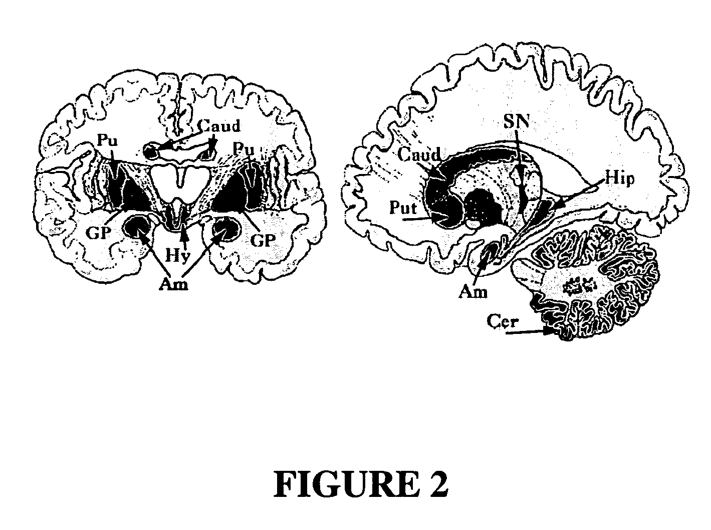 Methods for treatment of inflammatory diseases using CT-3 or analogs thereof