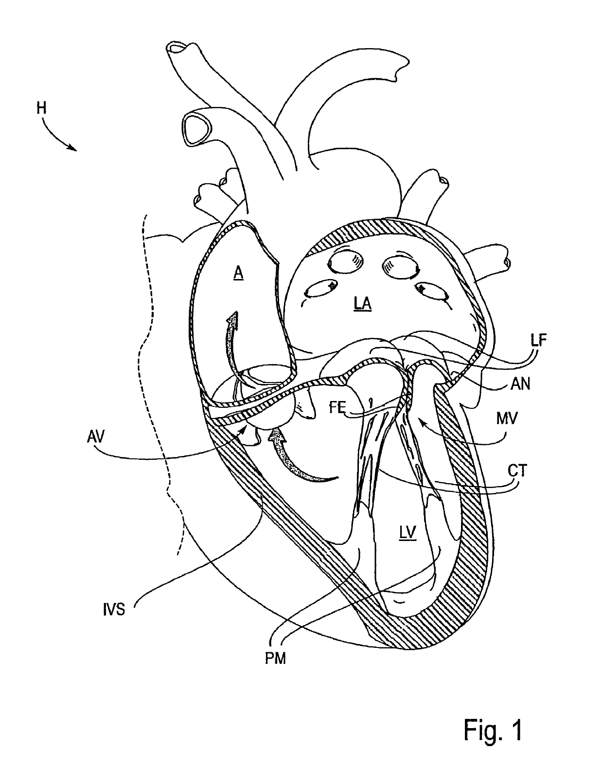 Delivery catheter handle and methods of use