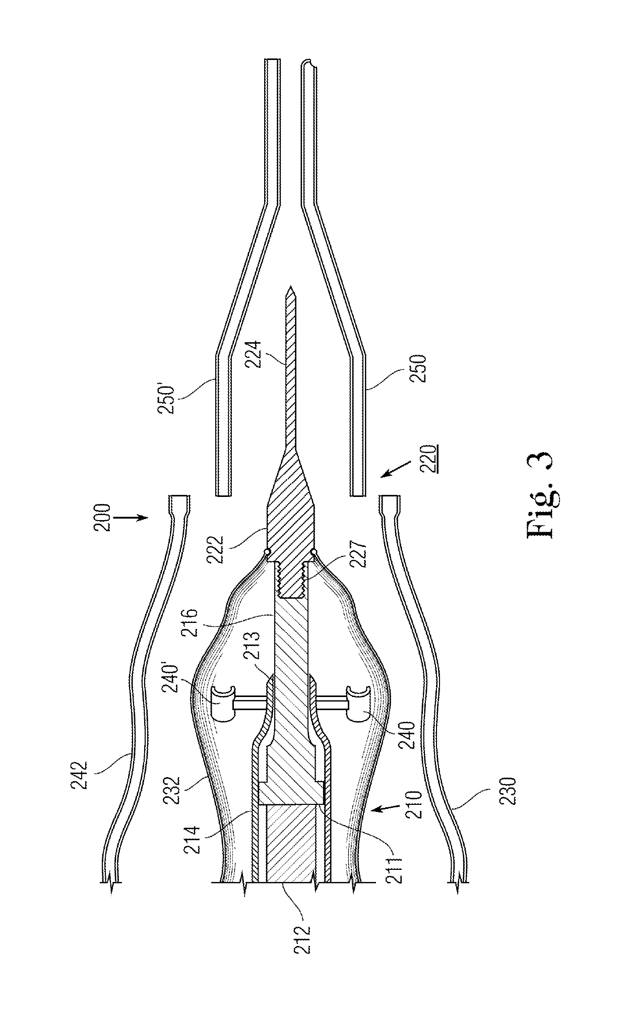 Dual lumen surgical hand-piece with ultrasonic knife