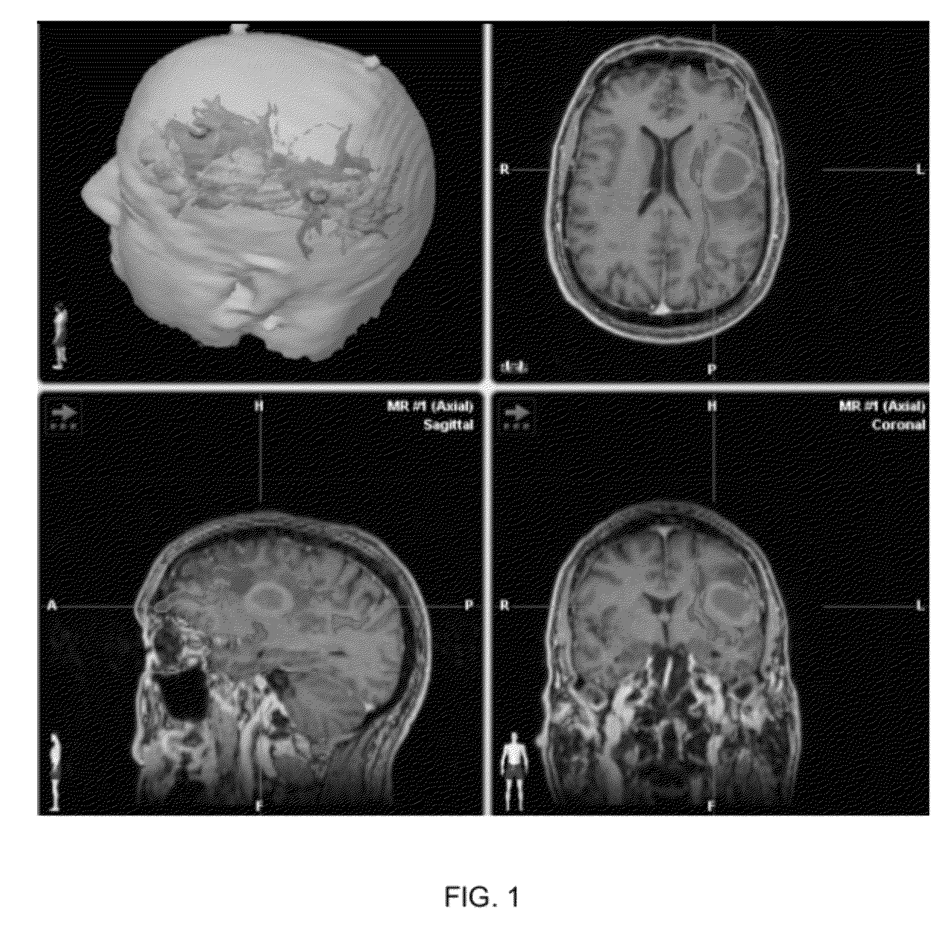 Method of rapidly visualizing essential neural pathways