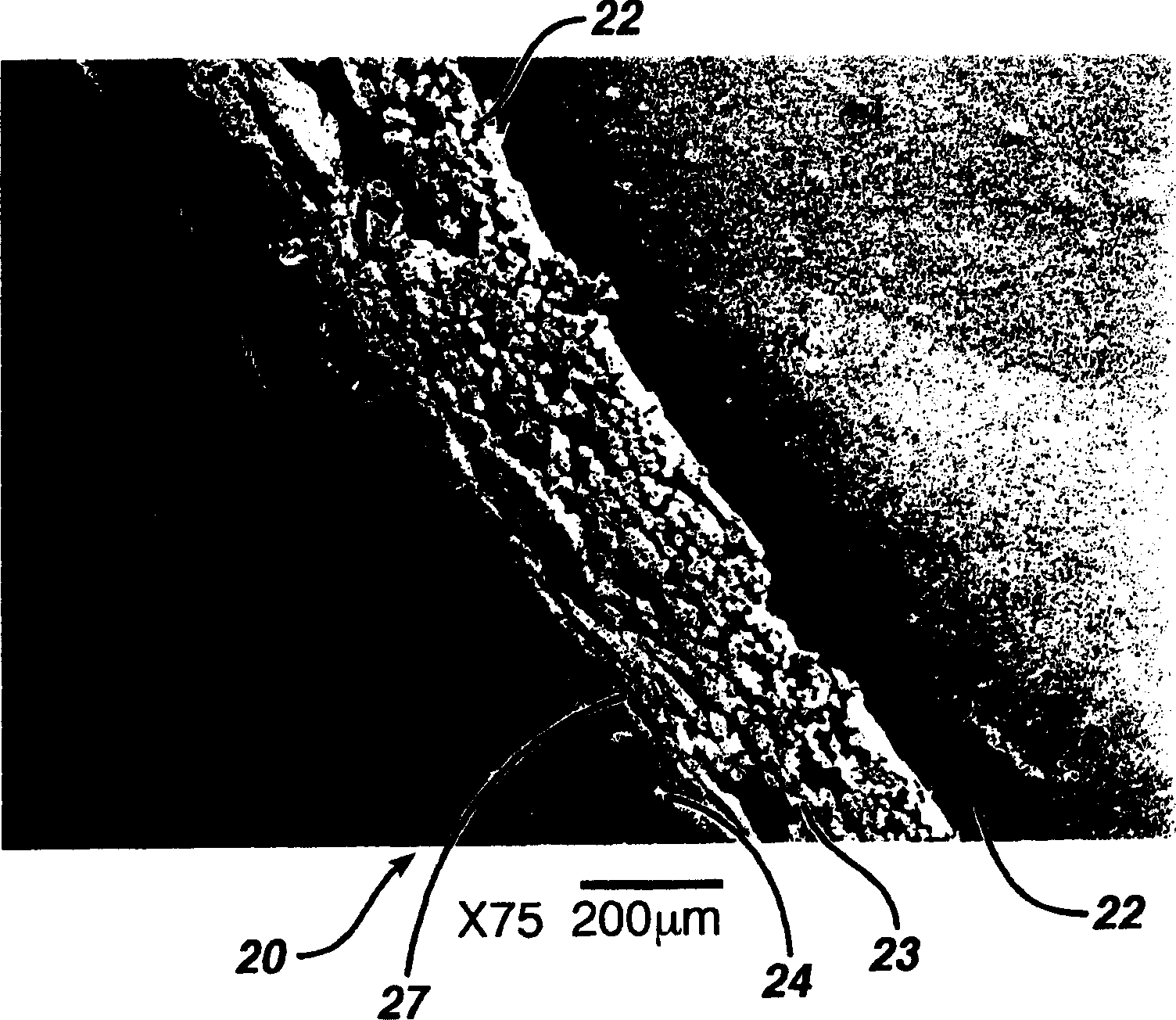 Hemostatic wound dressing and its producing method