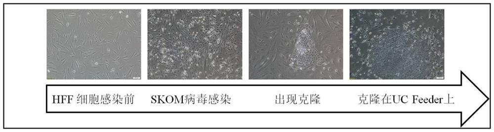 A method for culturing induced pluripotent stem cells using human urine cells as a feeder layer