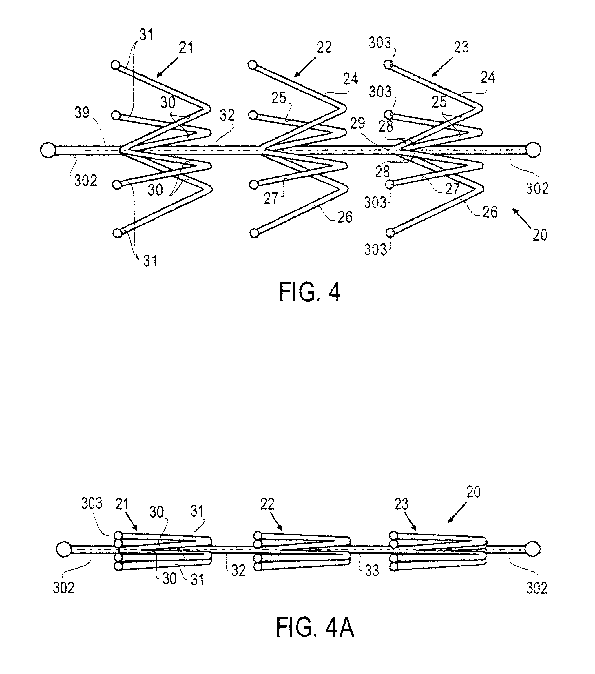 Methods and devices for deployment into a lumen