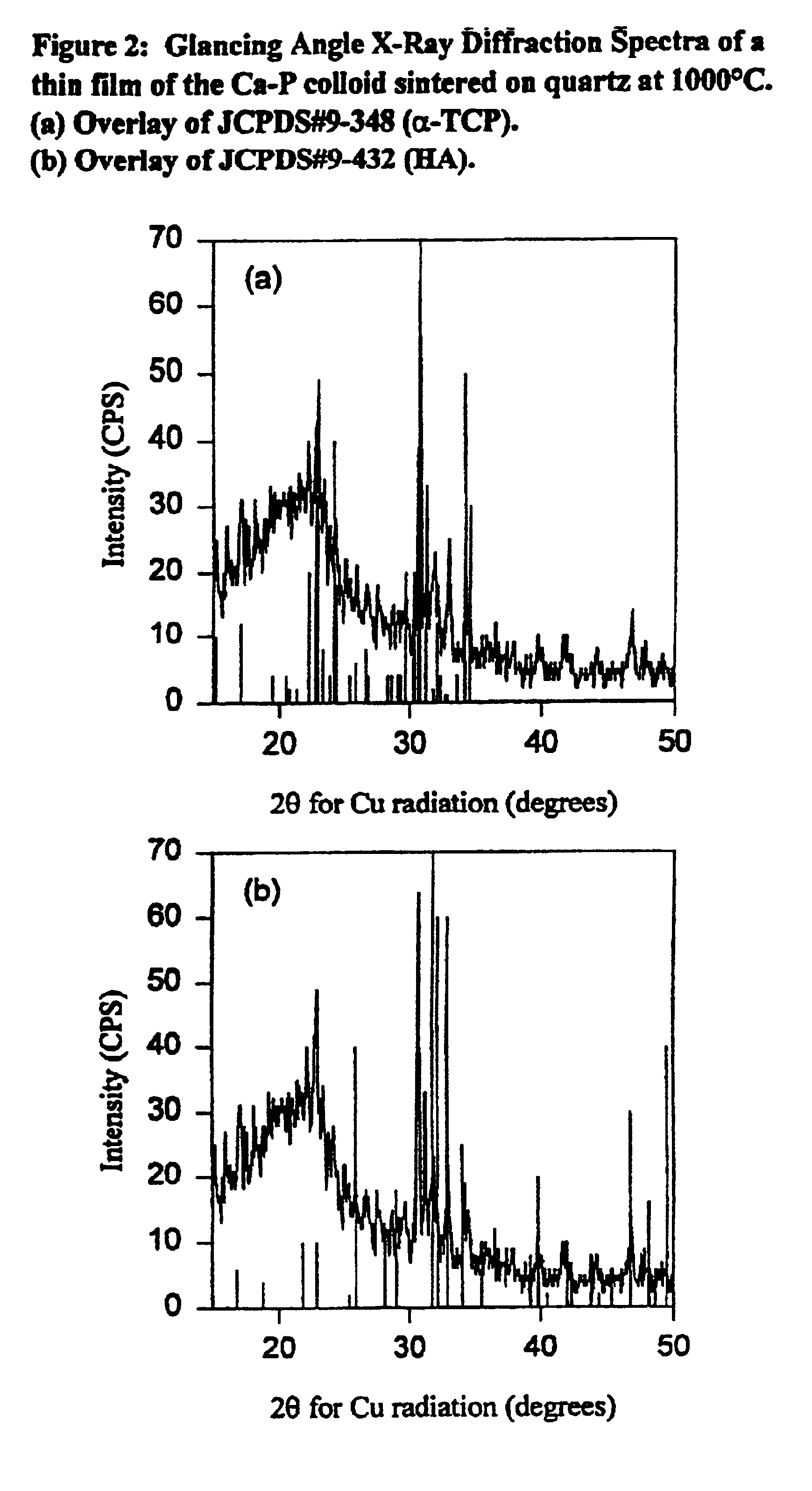 Synthetic biomaterial compound of calcium phosphate phases particularly adapted for supporting bone cell activity