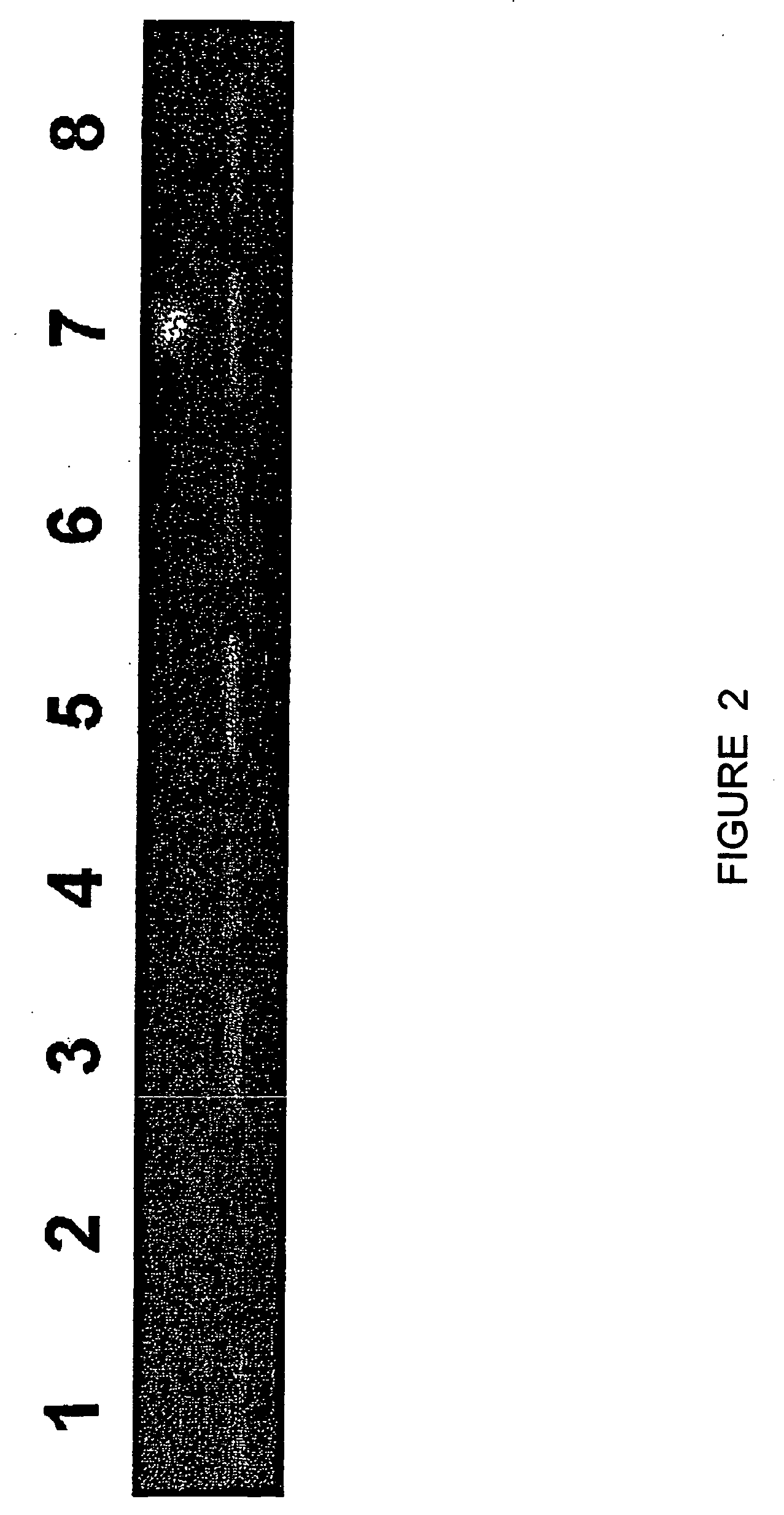 Method for the detection of osteoarthritis related gene transcripts in blood