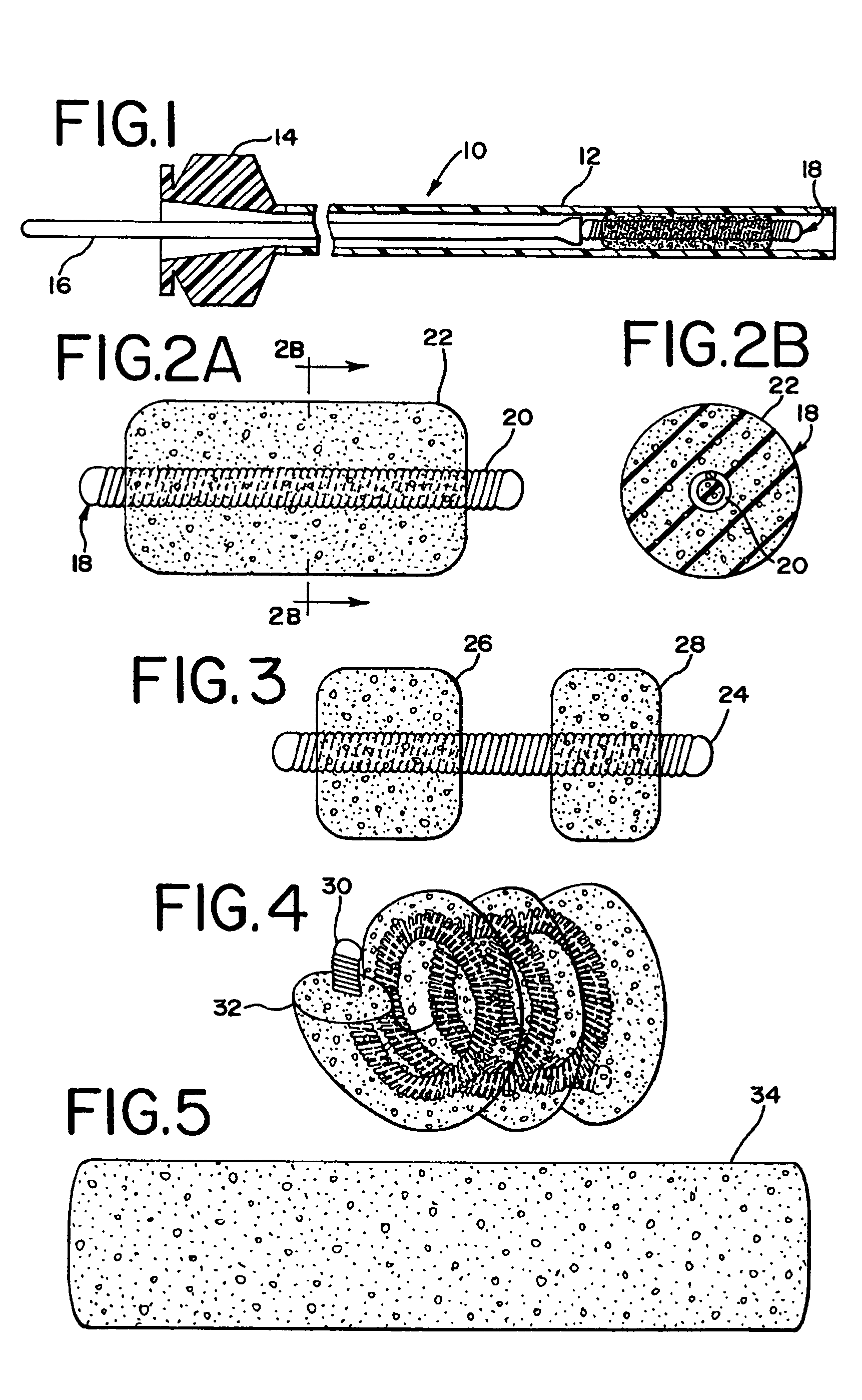 Foam matrix embolization device