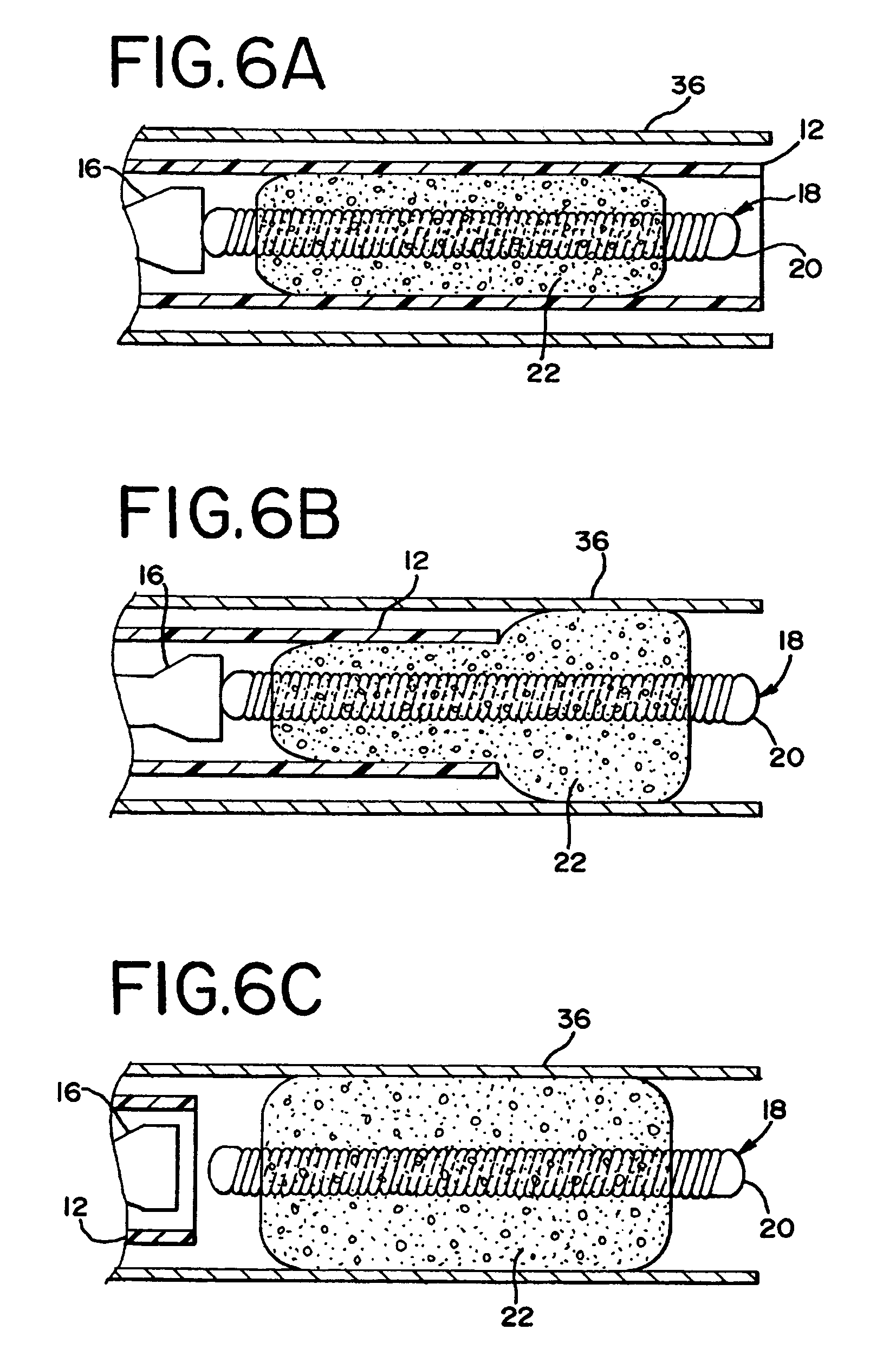 Foam matrix embolization device