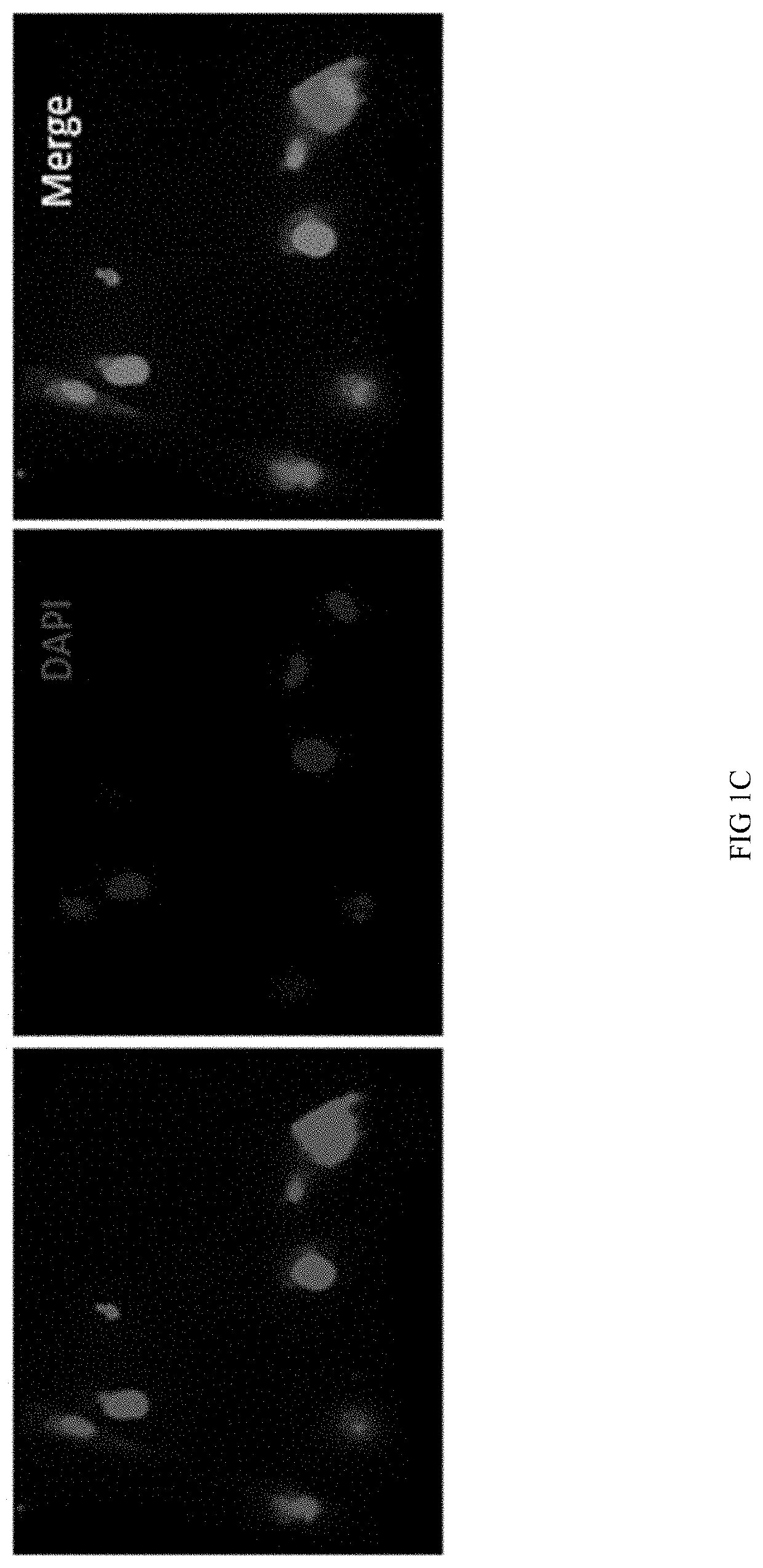 Compositions and methods for treatment of Gcase related disease states