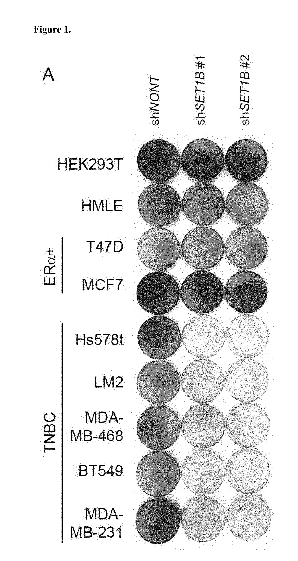 Therapeutic targeting of set1b/compass pathway for treating cancers