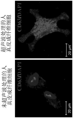 Composition for tissue regeneration and wound healing comprising induced exosomes