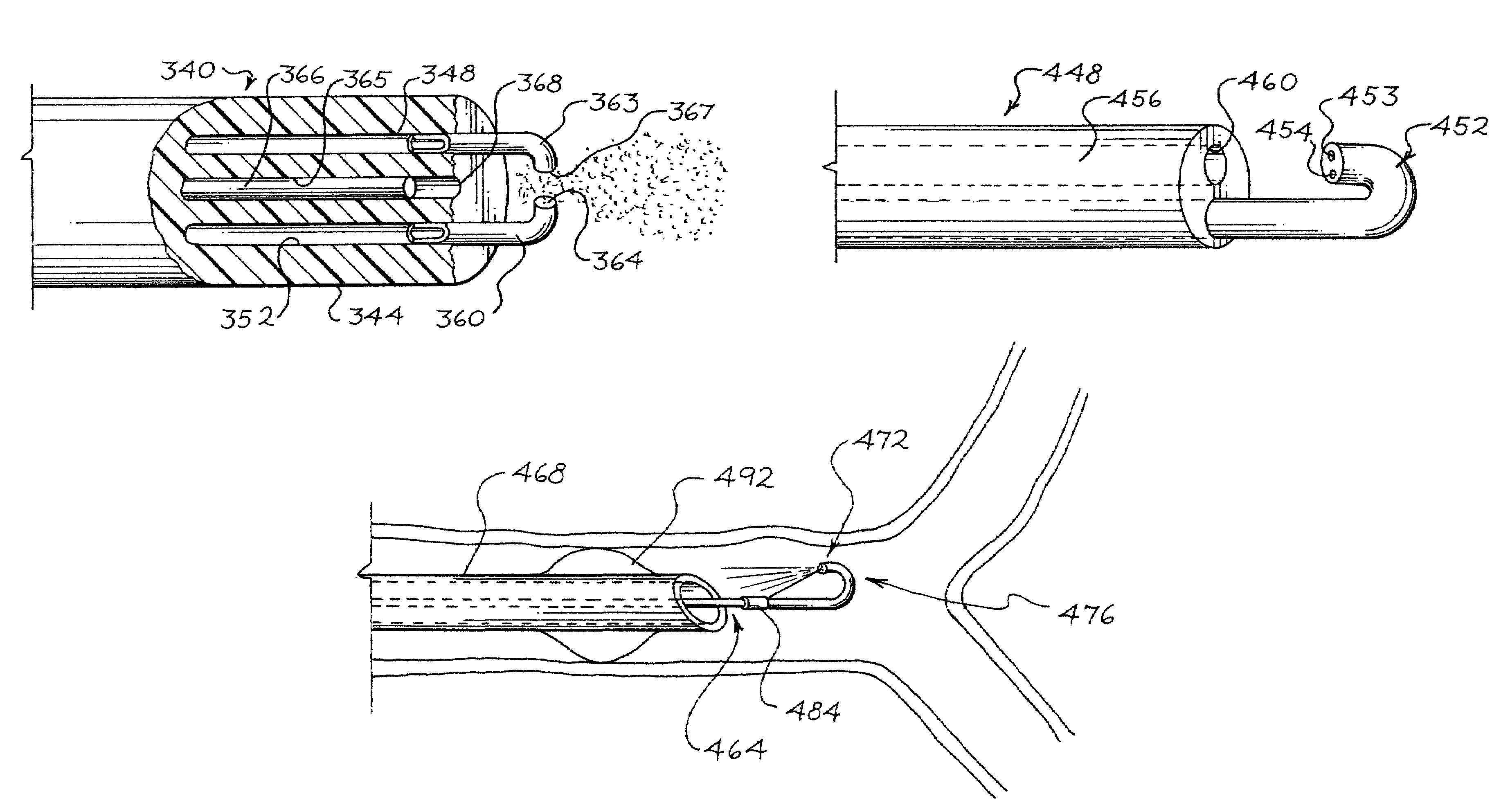 Nebulizing catheter system for delivering an aerosol to a patient