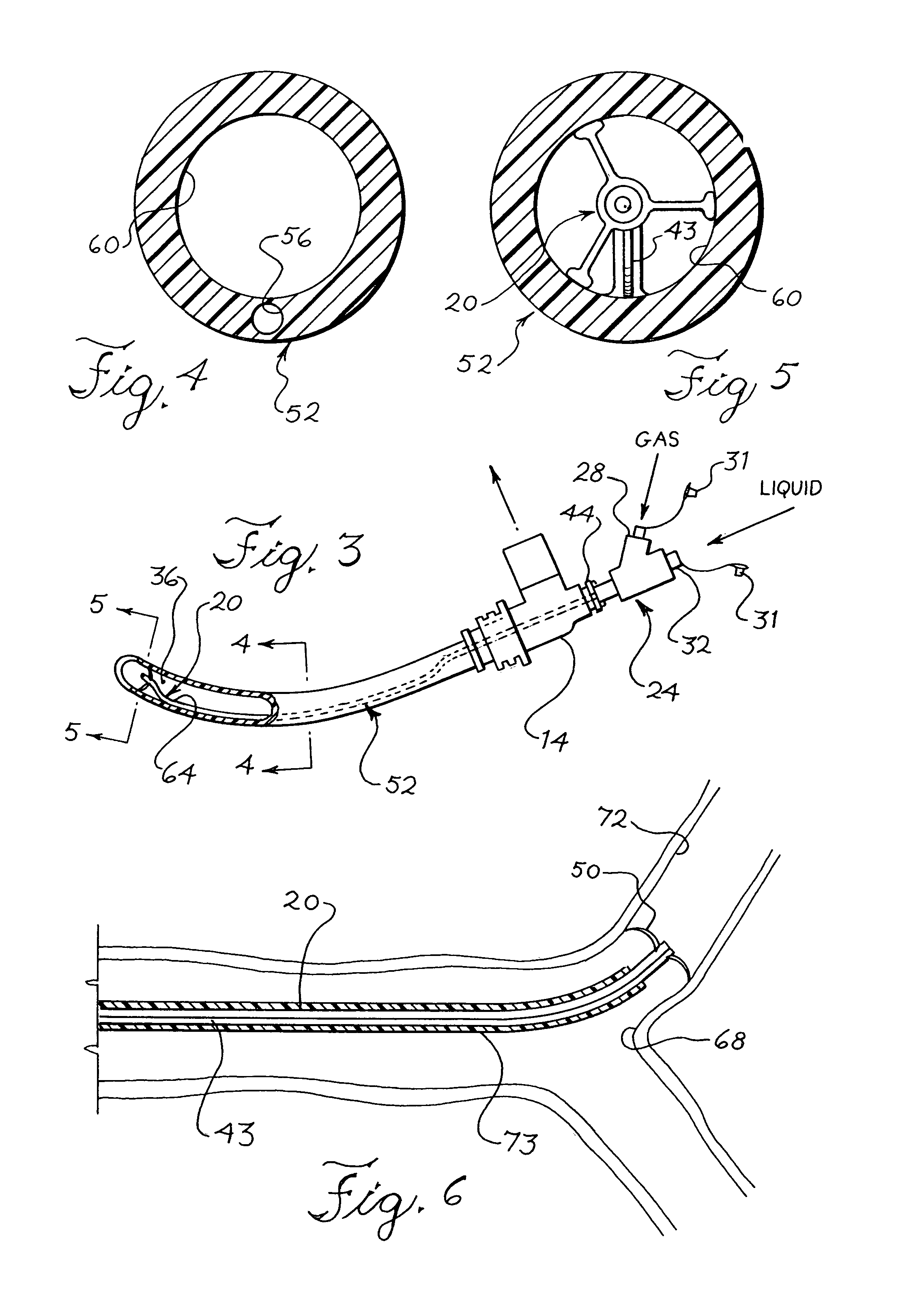 Nebulizing catheter system for delivering an aerosol to a patient