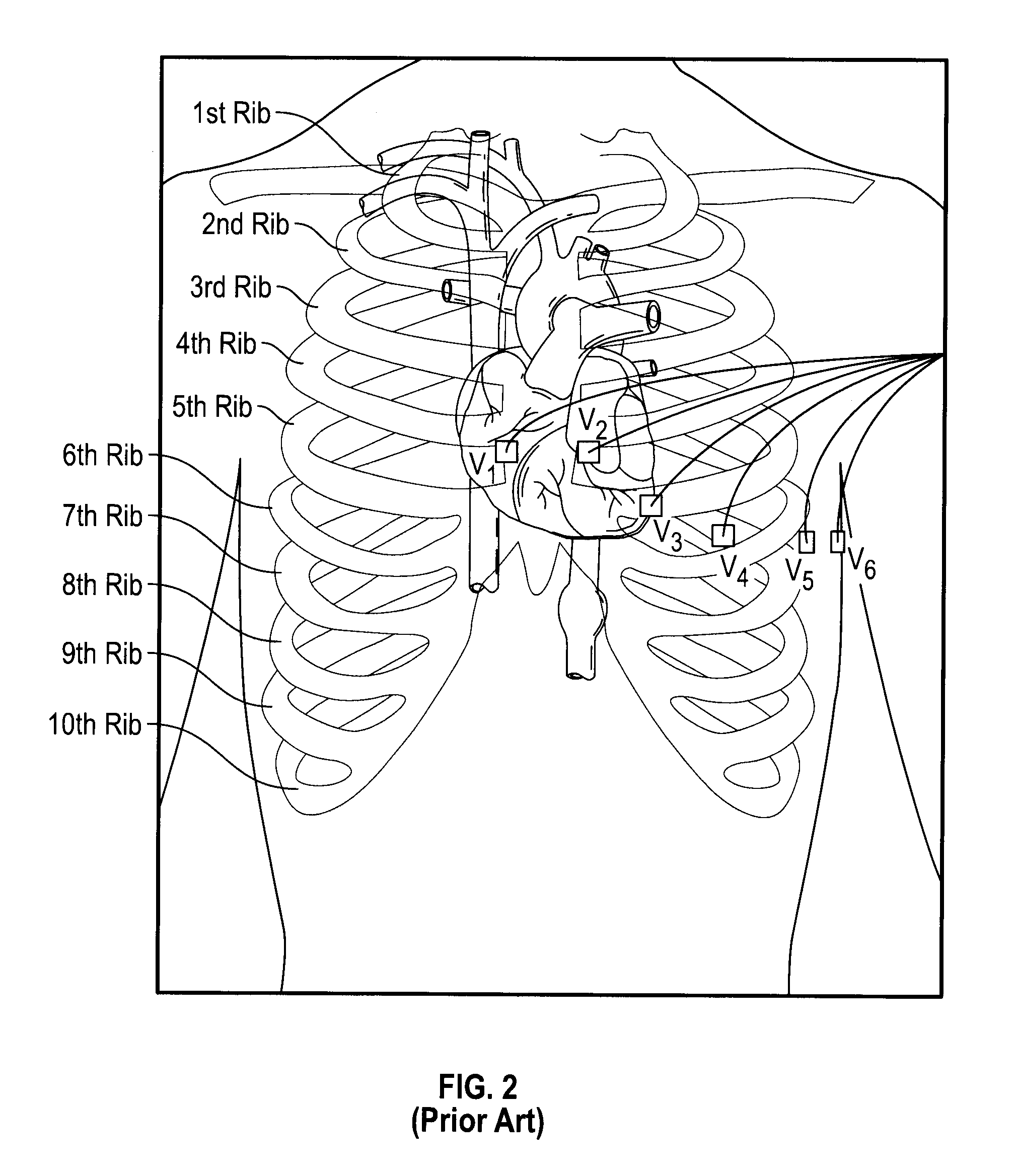 Two electrode apparatus and methods for twelve lead ECG