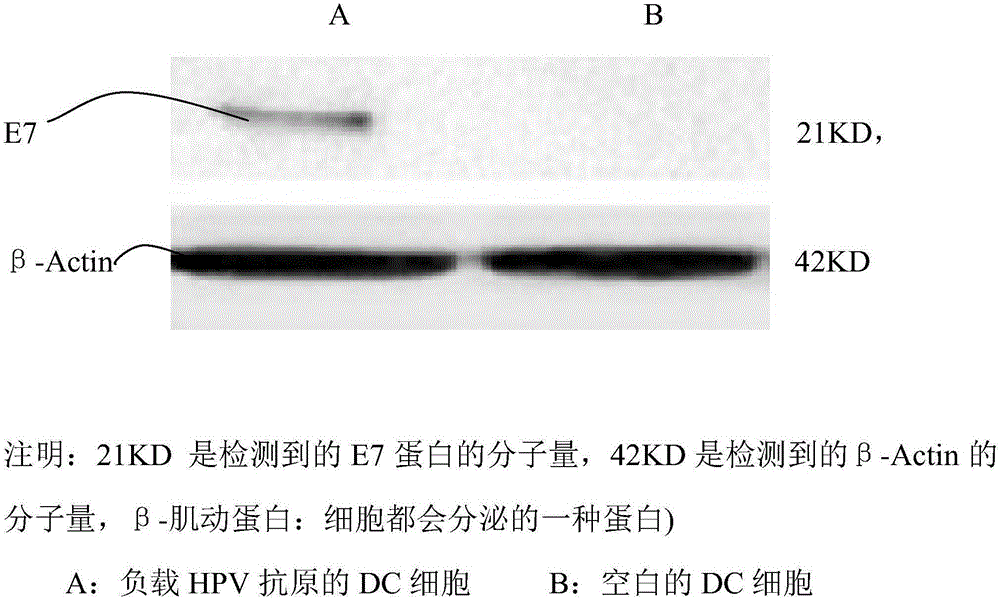 DC cell-based HPV virus vaccine preparation method