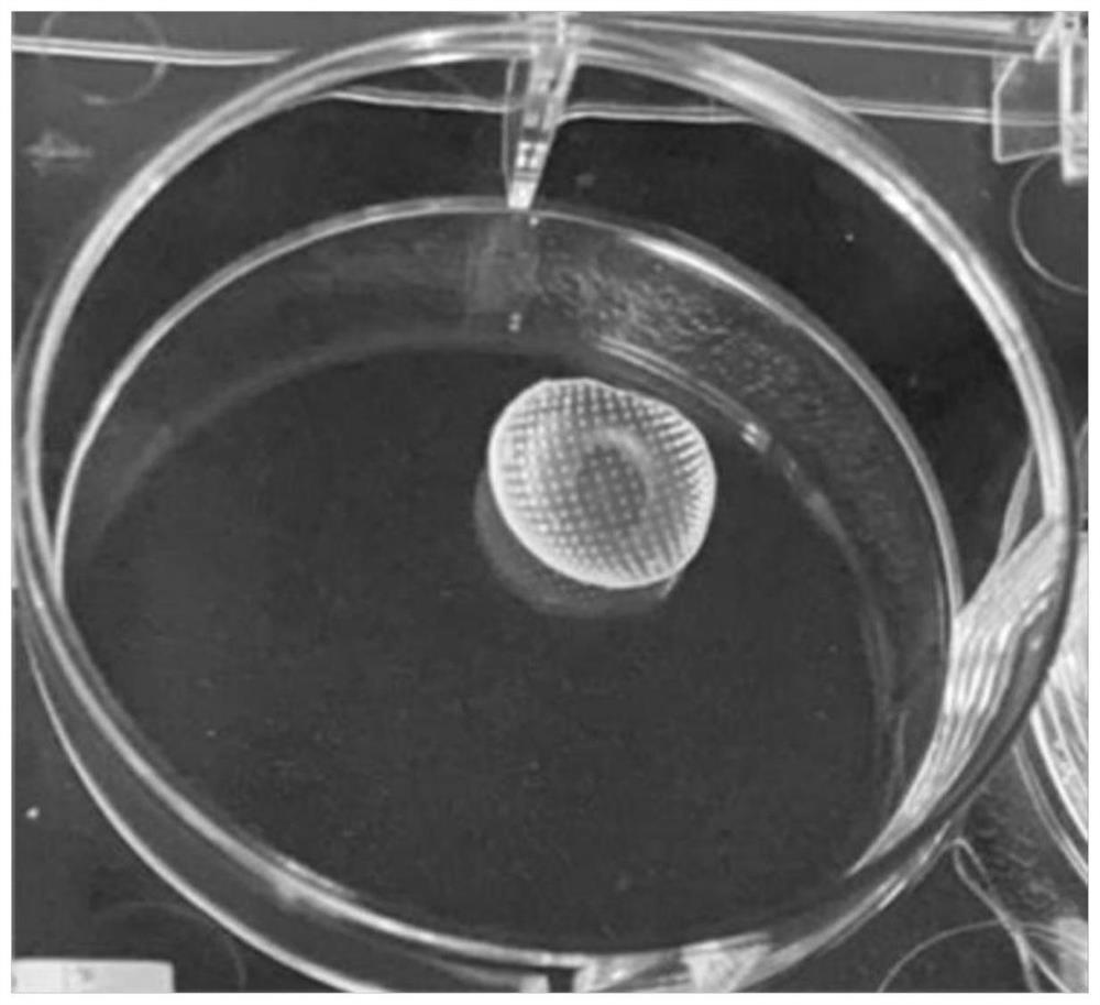 Heart microneedle patch loaded with TGF (Transforming Growth Factor)-beta inhibitor Galunsertib, and preparation method of heart microneedle patch