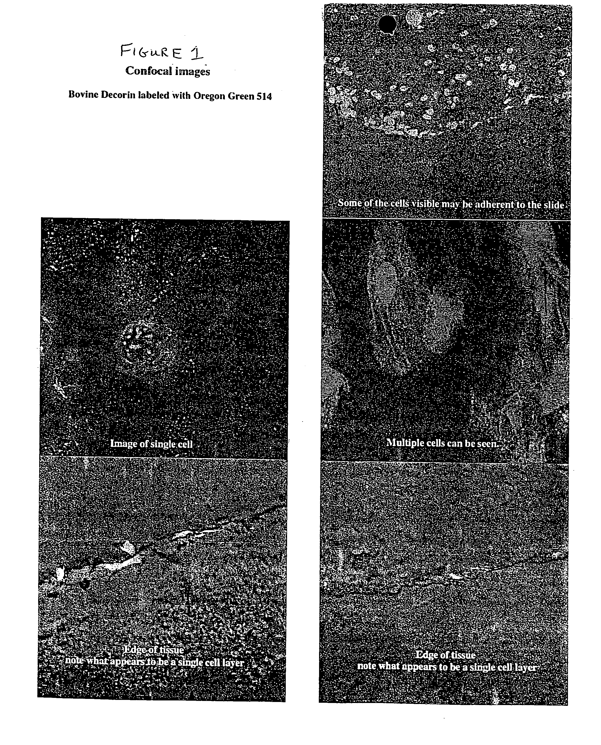 Composition for stabilizing corneal tissue during or after orthokeratology lens wear